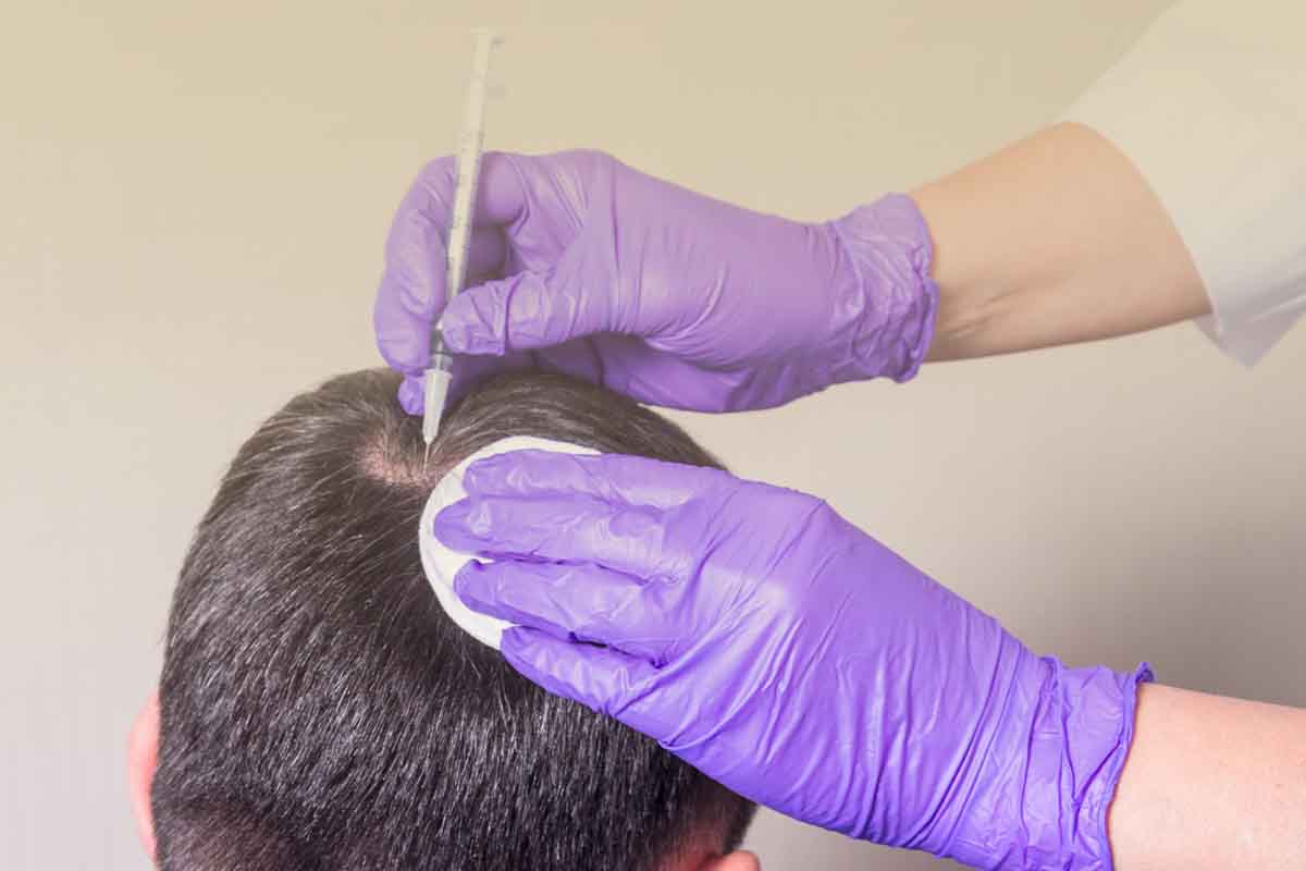 PRP Behandlungen in Mannheim